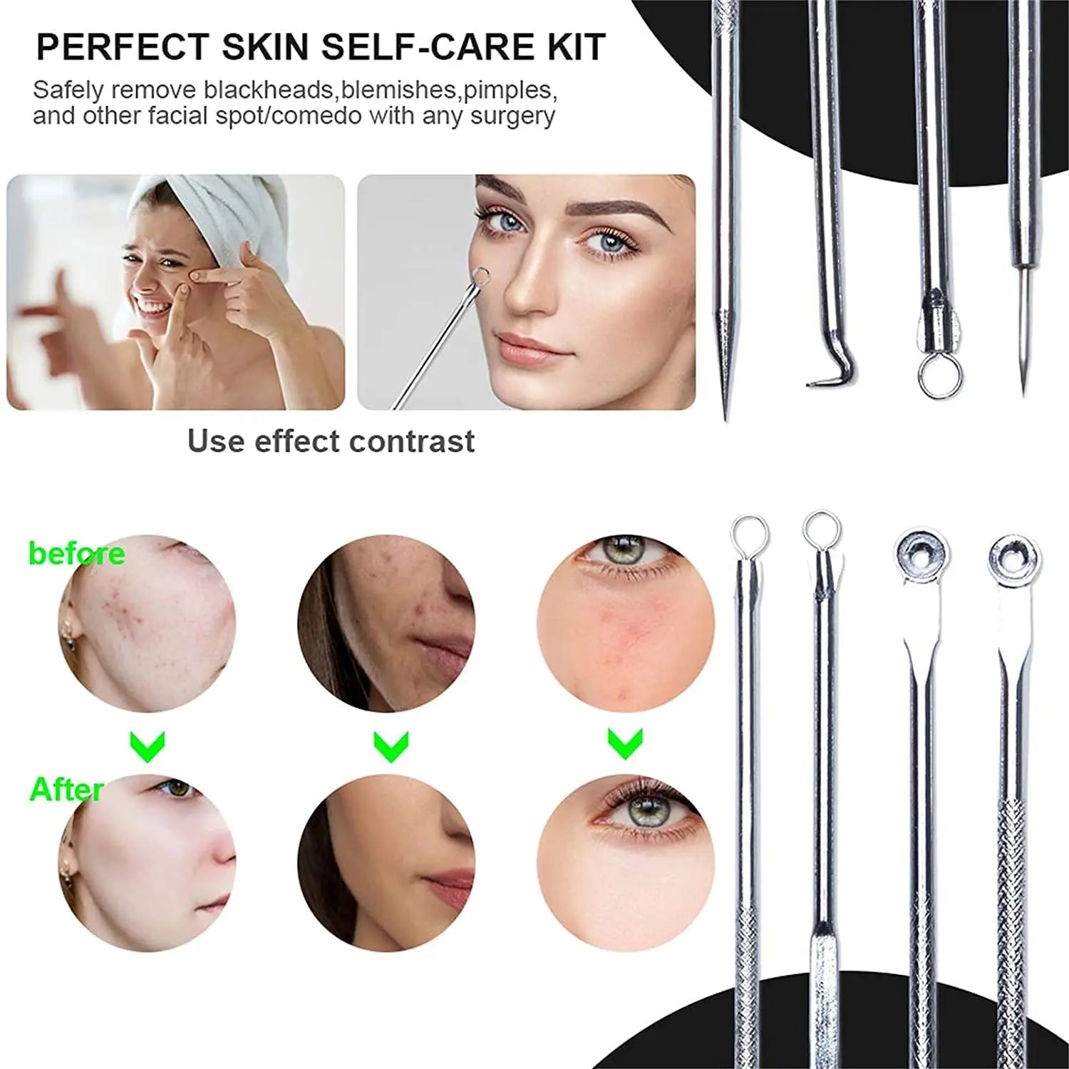 Blackhead Acne Remover 4pcs Comedone Black Head Blemish Pimple Removal Needle Face Skin Beauty Care Cleansing Pore Cleanser